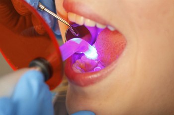 dentist in brandon ms Dental Bonding Header Image