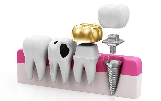 dentist brandon ms Restorative dentistry header image